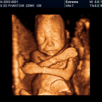Fetal Ultrasound Training Course