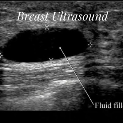Breast Ultrasound Course