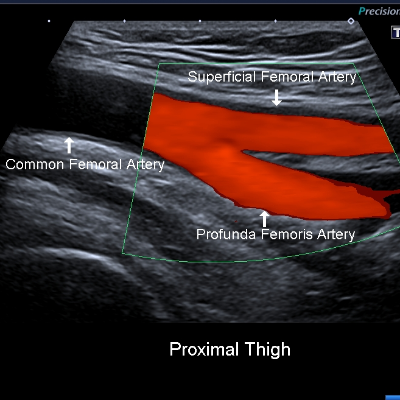 Vascular Ultrasound Courses